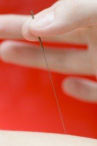 Acupuncture-needle-red
