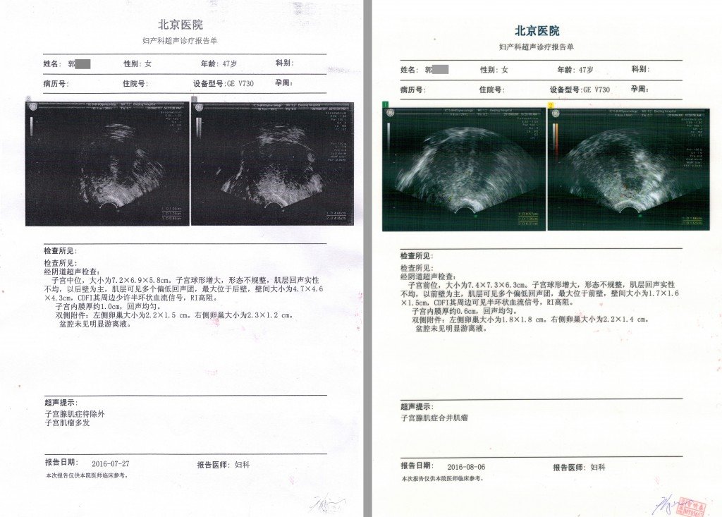 Figure2_Untrasound image and medical report for case 2
